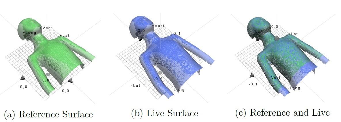 Het 3D-model zie je links in de afbeelding in het groen. In het midden, in het blauw, zie je de scan van de patiënt en in de rechtse afbeelding zie je dat de scan van de patiënt in het 3D-model past. De patiënt ligt goed!